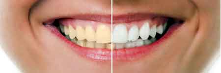 Cosmetic Dentistry