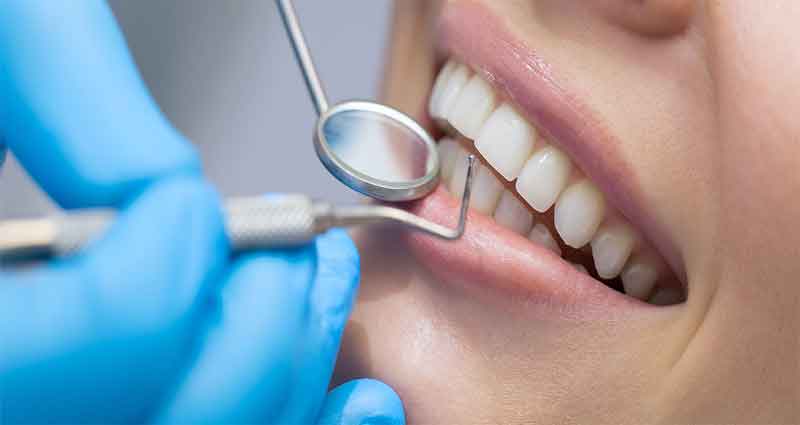 Comprehensive Regular Dental Checkup at Smile Centre India