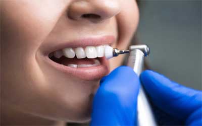 Comprehensive Dental exam