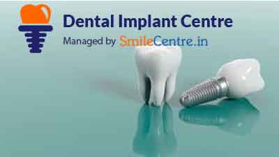 Dental Implant Centre